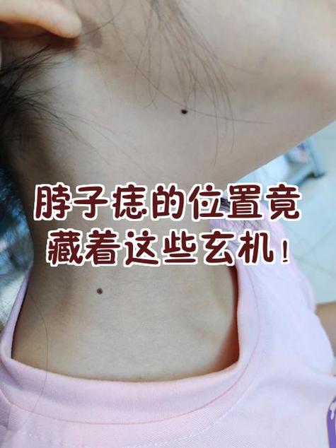 脖子對你的運勢會有什么影響