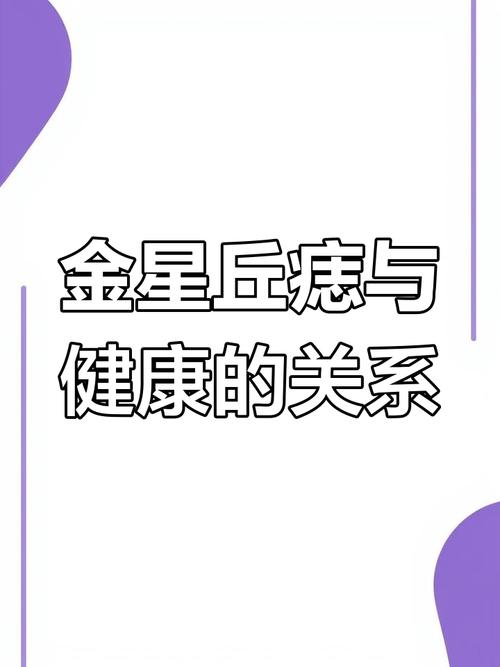 金星丘有痣代表什么 金星丘有痣好不好