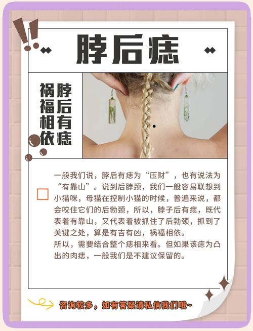 脖子后面有長黑痣好不好 脖子后面正中間有痣代表什么