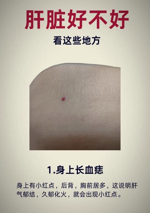 女人身上長(zhǎng)紅痣好不好 女人身上長(zhǎng)紅痣命理解析