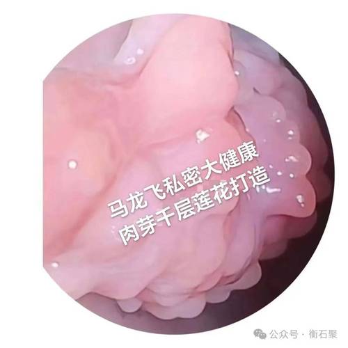 女性私密邊長痣有什么含義