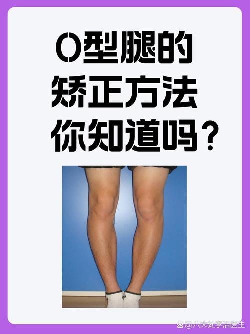 男人O型腿命運怎么樣