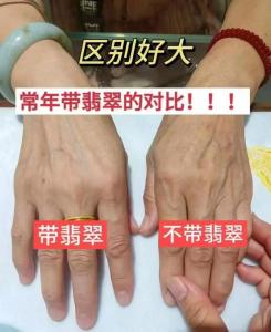 通過玉環(huán)紋看清你的身體健康狀況