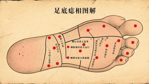 腳踏二星是什么命 腳踏二星痣相詳解