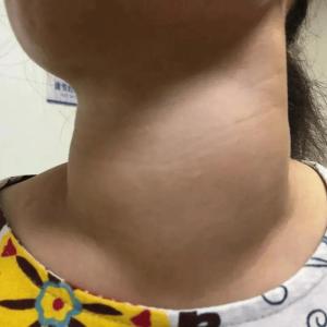 女人脖子粗有沒(méi)有福氣