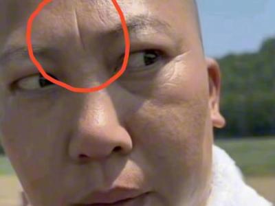 懸針紋是什么命運 女人額頭有懸針紋