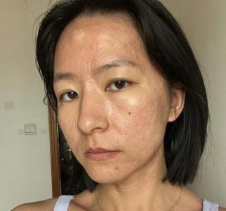 皮膚粗糙的女人運勢好不好