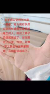 右手虎口長痣好不好 虎口有痣的男人女人代表什么