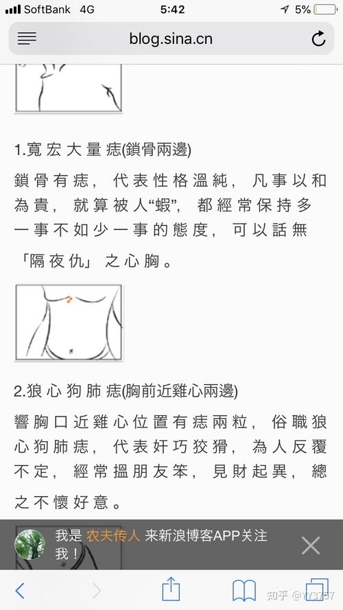 狼心狗肺痣代表什么