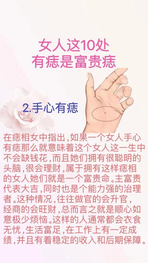 有貴子的痣