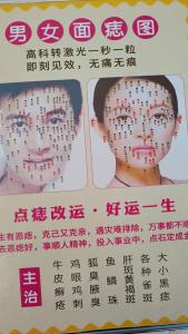 人中痣可以去掉嗎 貴人運旺盛事業(yè)成功優(yōu)秀