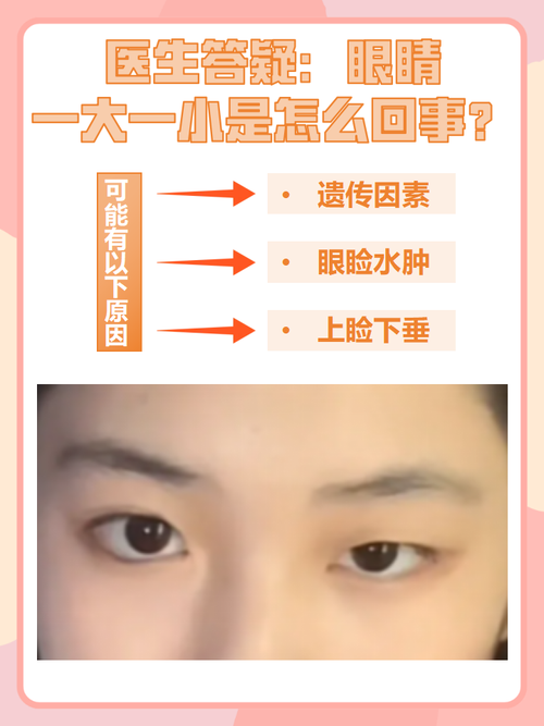 眼睛一大一小的人婚姻如何？