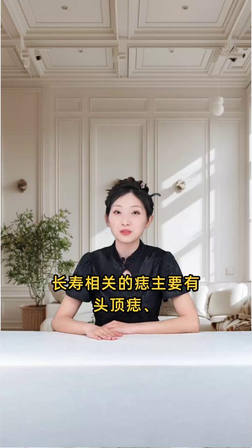 老來(lái)享福又長(zhǎng)壽的痣 額頭痣晚年運(yùn)勢(shì)提升