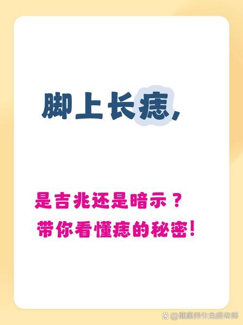 腳上長(zhǎng)痣好不好？腳上長(zhǎng)的痣吉兇分析