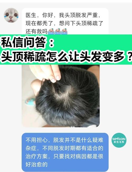 頭發看相：頭發稀疏與頭發濃密看相