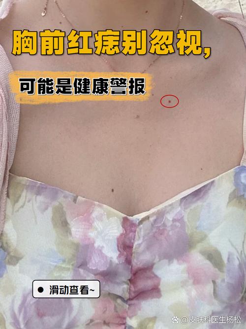 腰纏萬貫的痣長在哪里 胸部痣上等吉痣