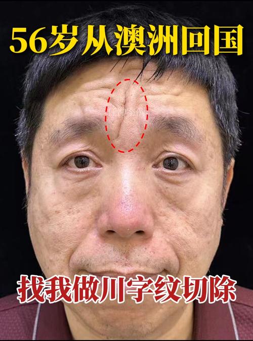 額頭皺紋看相：從額頭皺紋看性格與命運(yùn)