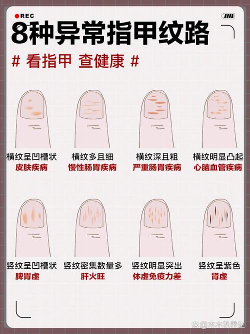 通過指甲顏色看身體健康狀況的好壞