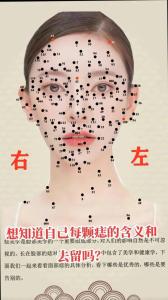 痣的位置與命運：身上的5個“惡痣”、“霉痣”