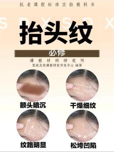 如何從抬頭紋看運勢