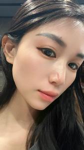 后天破相帶貴是真的嗎 鼻梁破相財運佳