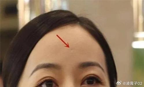 額頭凹陷是富貴坑圖片 額頭凹陷是富貴坑嗎