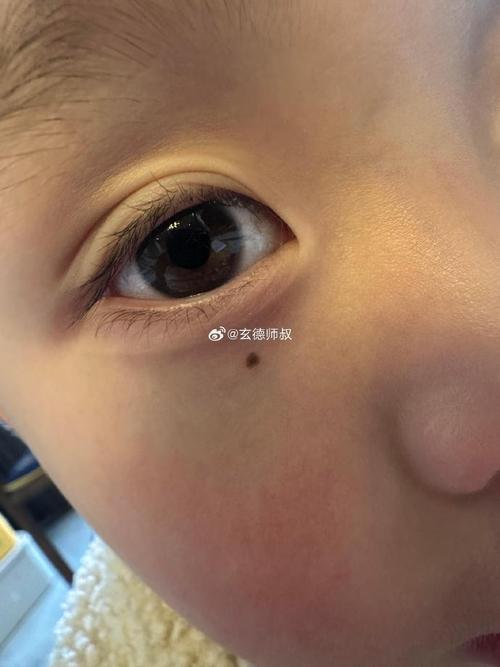 左眼有淚痣的女孩好嗎 關(guān)于左眼淚痣的傳說