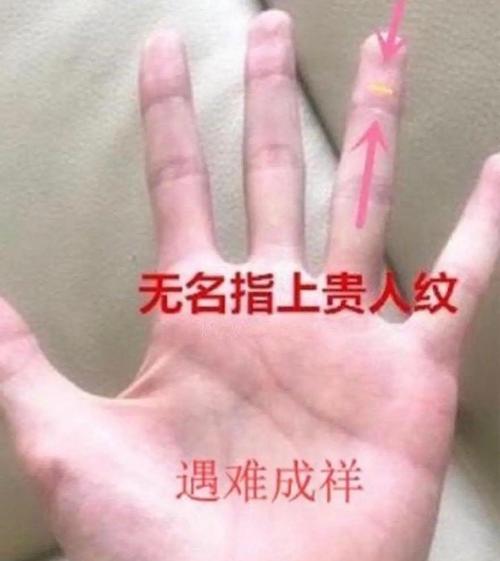 大拇指上有這種紋的人，男娶富妻女嫁貴夫