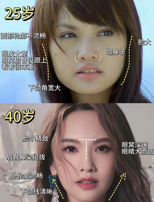 整容是否能改變面相
