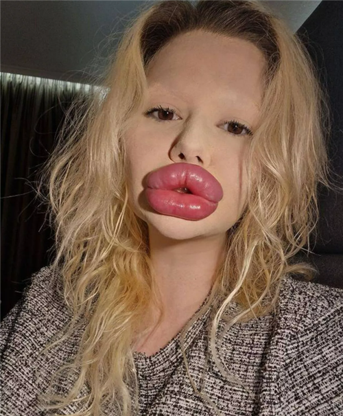 嘴大的女人命好嗎