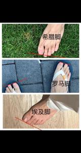 男人希臘腳性格怎么樣