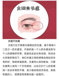 太陽穴有痣代表什么