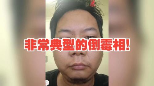 天生倒霉相