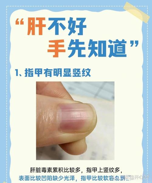 指甲較寬大的話代表著什么