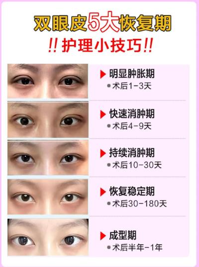 陰陽眼一般幾月出生 怎么后天形成