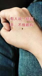 右手虎口有痣的女生 女人右手虎口有痣的命運分析