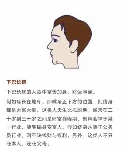 三世財運分析 下巴有痣的人財運好不好