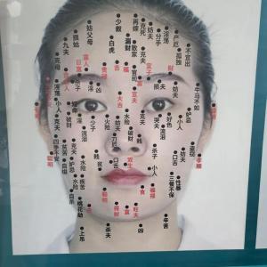 眉毛里面長痣好不好 不同位置的眉毛痣的含義