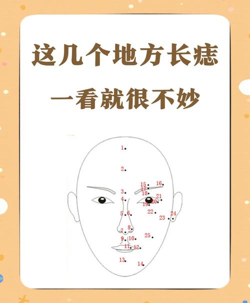 哪個部位的痣不能點