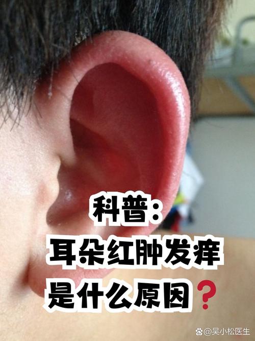 耳朵紅代表什么預兆