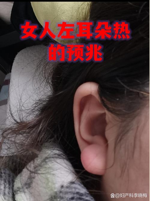 女人左耳燙是什么征兆