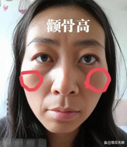 顴骨突出無肉是不是大貴之相呢