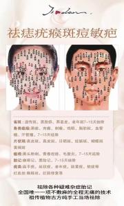 女人臉上黑點(diǎn)的講究