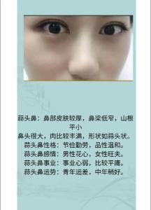 鼻子看相圖解：蒜頭鼻是什么樣的