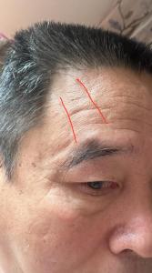 男人額頭上沒有抬頭紋運(yùn)勢(shì)好么