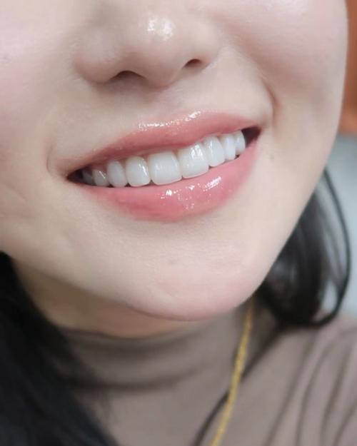 女生面相福氣 唇紅齒白則人中清晰