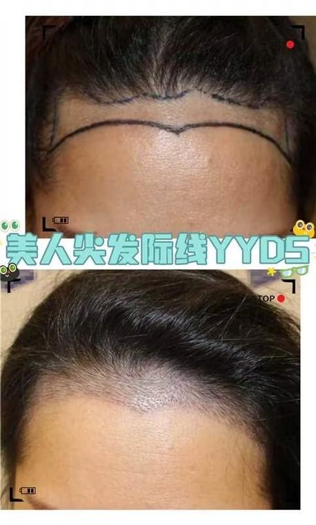 有美人尖的女人命運好不好 一生廣積福德則子孝孫賢