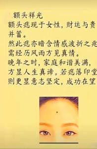 為什么說額頭上的痣不要去除 事業(yè)順利生活大富大貴