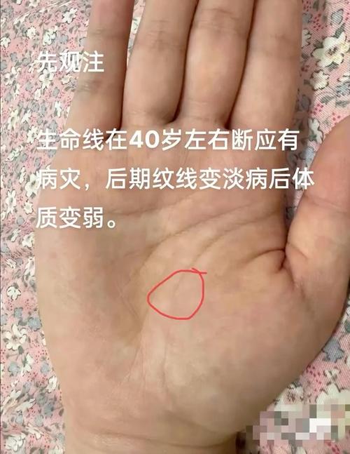 生命線特征提醒你留意身體健康
