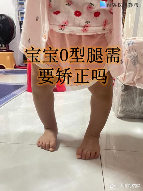 腿部畸形影響運勢嗎